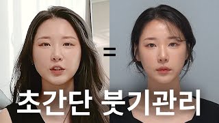 촬영 전 연예인들이 꼭 한다는 붓기관리 4가지