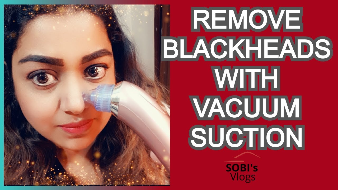 DIY How to Use Vacuum Suction Machine To Remove Blackheads Urdu/Hindi YouTube