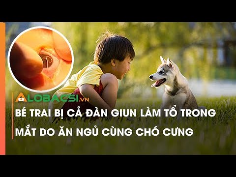 Video Bé trai bị cả đàn giun làm tổ trong mắt do ăn ngủ cùng... - youtube