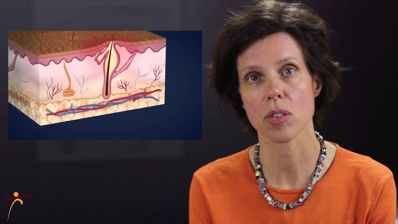 Acne Treatment in Philadelphia - By Dr. Ringpfeil - Board certified dermatologist