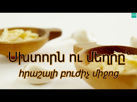 Video: Որքա՞ն խորն է փոստարկղի փոստի անցքը: