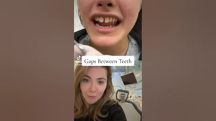 2 Ways To Close Front Teeth Gaps!