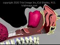 Endotracheal Intubation Animation by Cal Shipley, M.D.