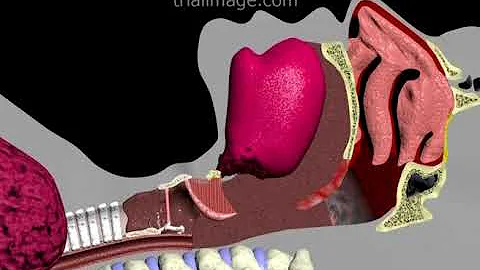 Endotracheal Intubation Animation by Cal Shipley, M.D.