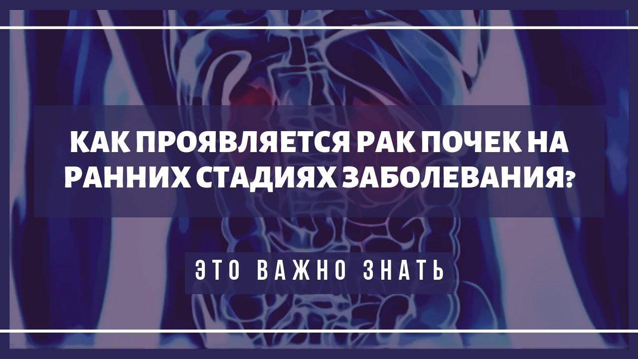 ⁣Первые симптомы рака почки