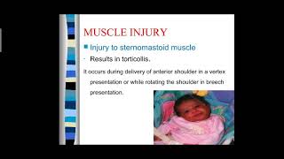 BIRTH INJURY | NEONATAL DISORDERS | OBG screenshot 5