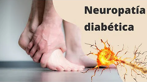 O que provoca a neuropatia diabética?