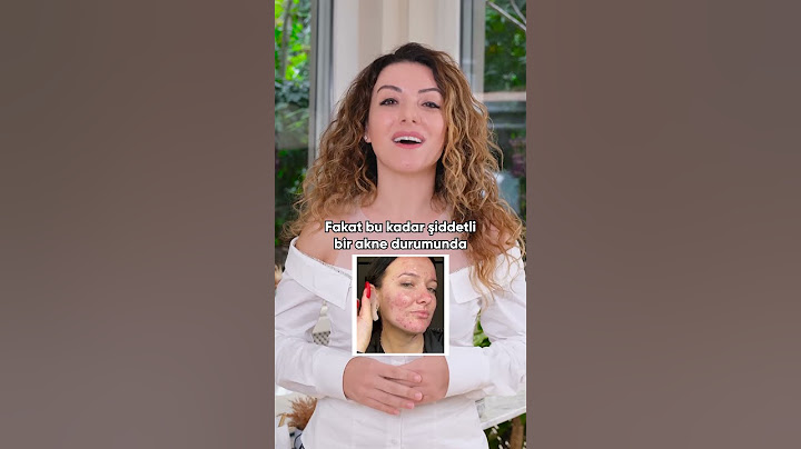 Akne (Sivilce ) Bantları Hangi Durumda Kullanılır?