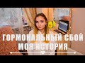 Гормональный Сбой/ Поликистоз (СПКЯ) 1 часть