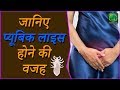 Pubic lice    pubic lice      treatment and prevention  lotus ayurveda india
