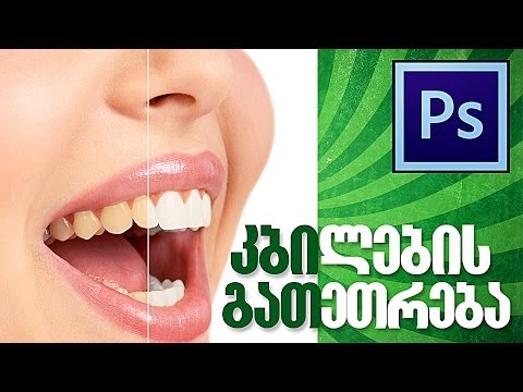 კბილების გათეთრება ფოტოშოპში - Photoshop teeth whitening tutorial