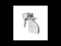 Coldplay - Politik (from the album A Rush Of Blood To The Head)