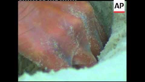 Biologists move turtle eggs to save them from oil slick