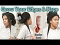 MUST TRY NOW‼️Grow Your Edges and Your Nape Hair by Following These Tips ➿️