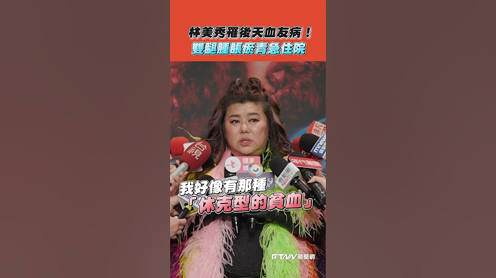 【#shorts 】 #林美秀 罹後天血友病！  雙腿腫脹瘀青急住院