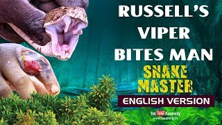 Russell’s viper bites man | Watch what happened to Roy Thomas | Snakemaster English | EP 11