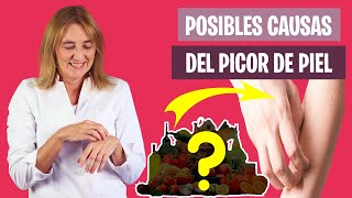 CAUSAS y SÍNTOMAS de PICAZÓN de PIEL | Qué alimentos pueden provocar picor | Nutrición y Dietética