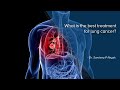 What is the best treatment for lung cancer  dr sandeep nayak