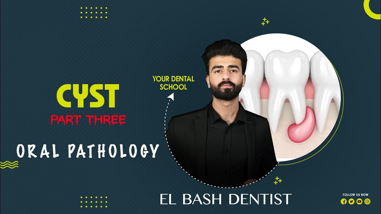 cysts || part 3 || oral pathology _ عزت شومان