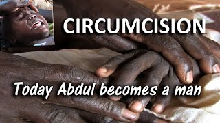 Circumcision: A Painful Rite of Passage