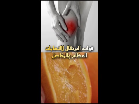 فوائد البرتقال وعصير البرتقال للعظام لالتهابات المفاصل
