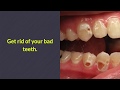 Why Do People Get Bad Teeth?