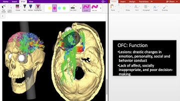 Frontal Lobe Circuits 3 (Orbitofrontal Cortex) OFC