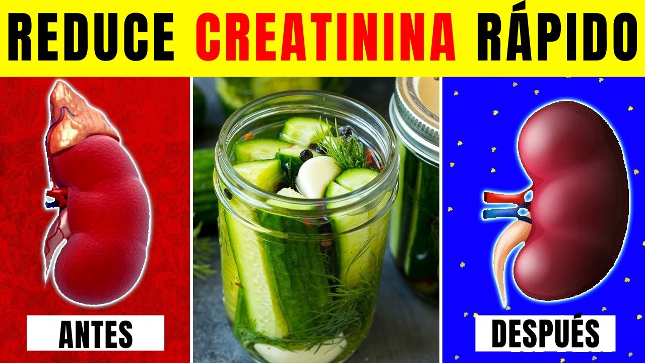 6 Superalimentos que Reducen los Niveles de Creatinina RÁPIDAMENTE y ...