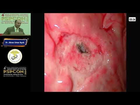 Day 03 || Dr. Jibran Umar Ayub || GASTROENTEROLOGY & HEPATOLOGY – KEY INSIGHTS ||