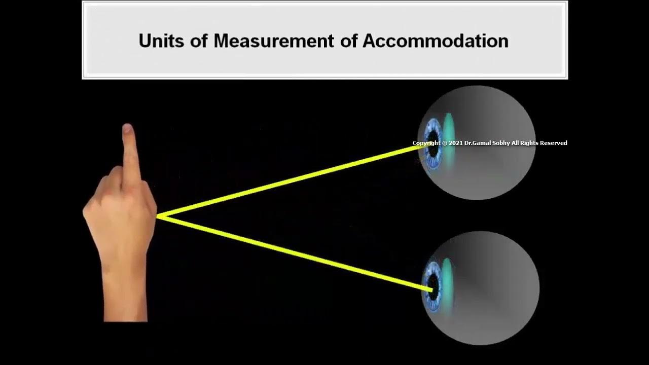 5 The Near Vision Complex Animated Book Binocular Vision and Ocular