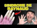 SÍNDROME DE RAYNAUD Y LUPUS: CÓMO IDENTIFICAR LOS CAMBIOS DE COLOR EN TUS MANOS