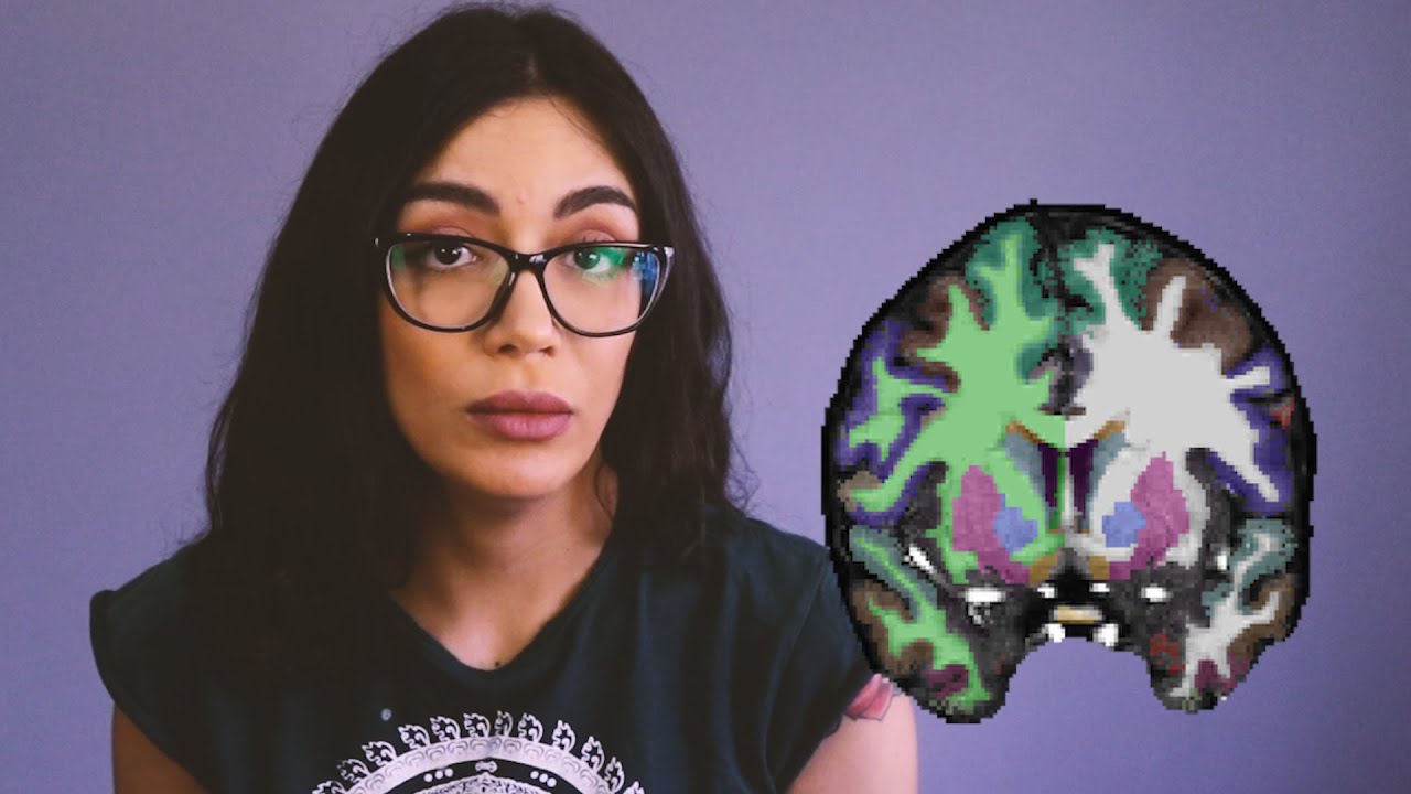 الشيزوفرينيا والانفصال عن الواقع | سلام قطناني