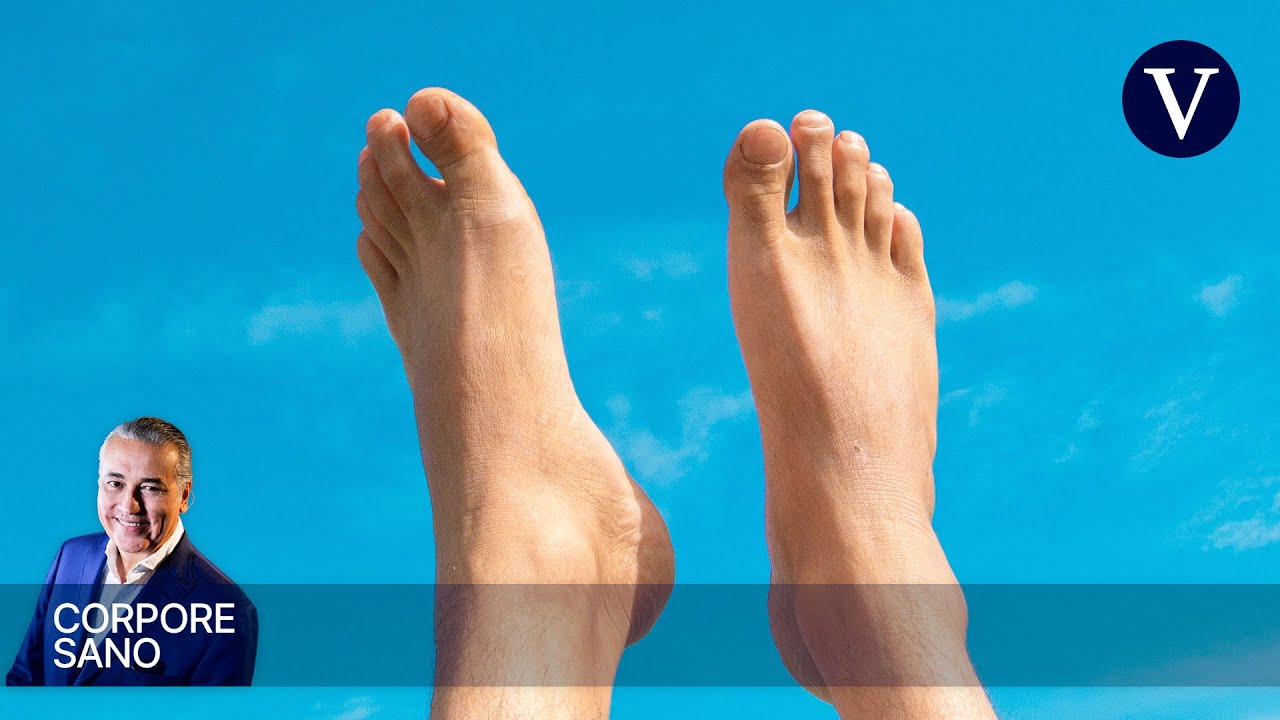 Así se realiza el acortamiento de dedos de los pies | Corpore Sano