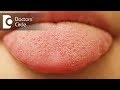 What causes small red patches on tongue  dr sana taher