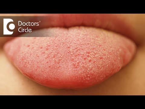 Video: Red Plaque On The Tongue - The Causes Of Education, What Does He Talk About, How To Treat?