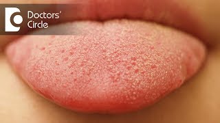 What causes small red patches on tongue? - Dr. Sana Taher