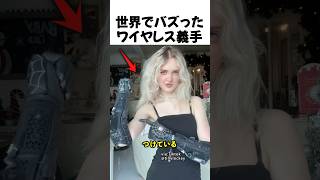 ワイヤレスの義手