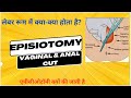 जानिए एपीसीओटॉमी क्यों की जाती है | बच्चे के जन्म के दौरान यह क्यों होता है?