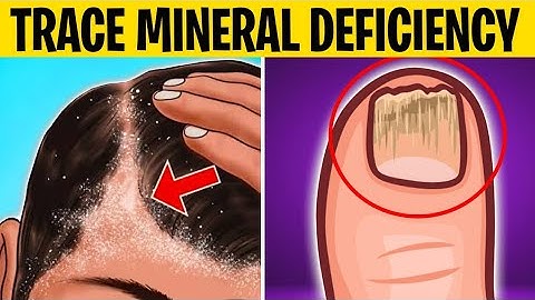7 Signs Your Body Need Trace Minerals