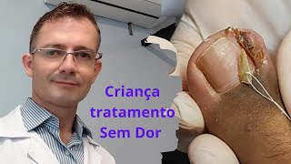 Tratamento De unha encravada sem dor , em crianças