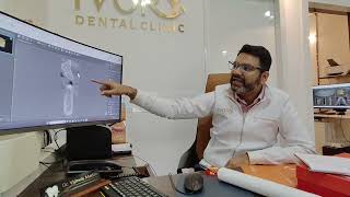 CBCT discussion for implant placement with Doctors Cbct Analysis For Regular Implant Cases