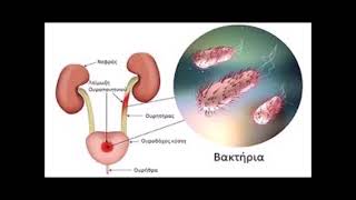 Ουρολοιμωξη