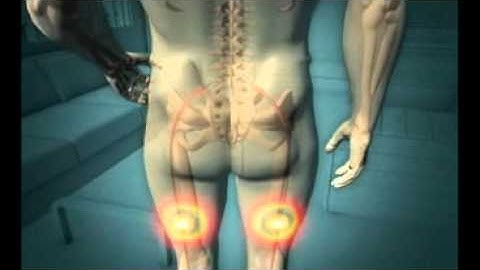 How spinal decompression works