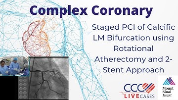 Staged PCI of Calcific LM Bifurcation using Rotational Atherectomy & 2-Stent Tech. March 2016 Video