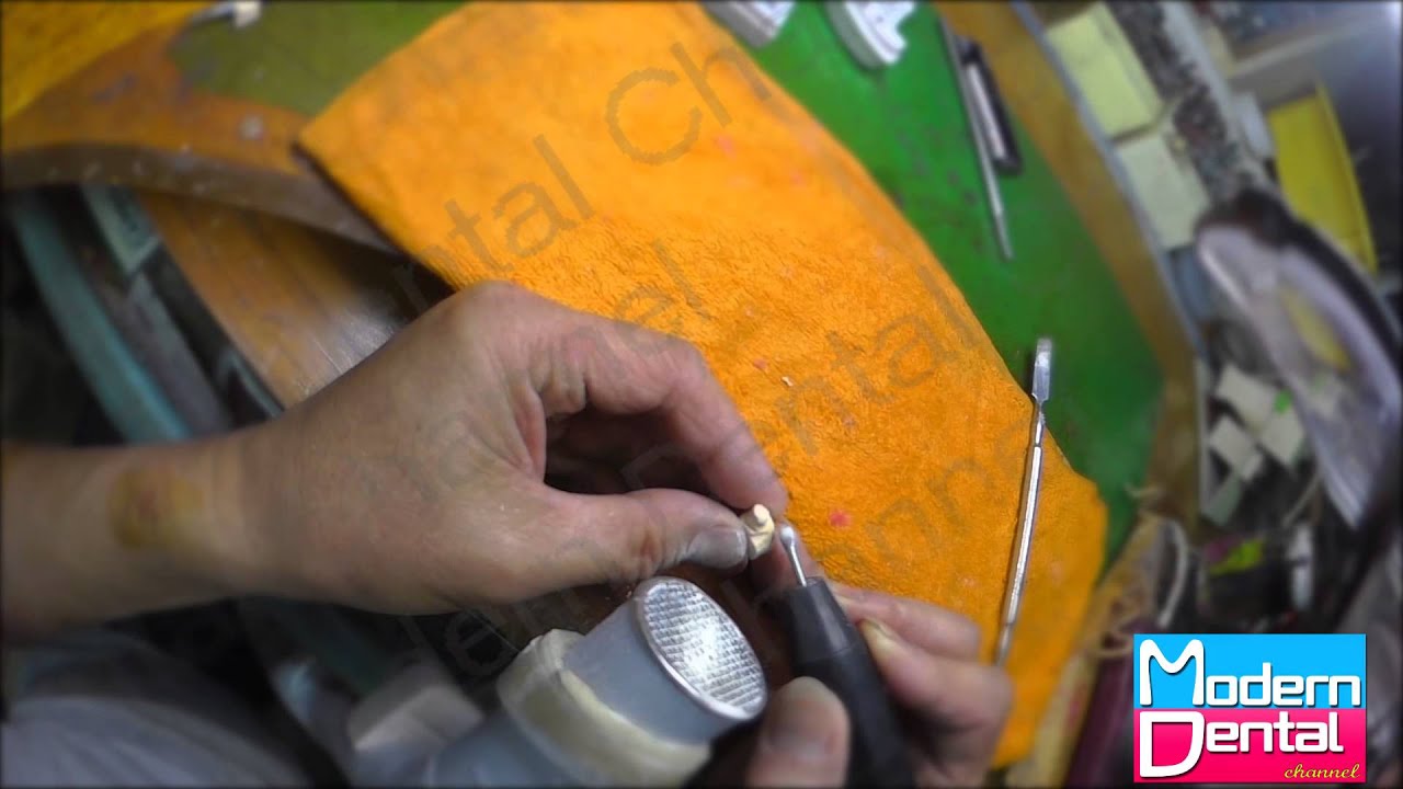 【歯科技工】ワックスアップ２ part2