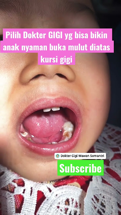 DENTAL NERVE TREATMENT FOR CHILDREN WITH CAVITIES & FREQUENT PAIN #children'steeth #dentalnervetr...