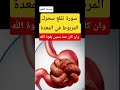 سورة تقلع سحرك من المعدة وان كان منذ سنين بقوة الله