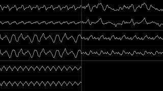 SkylarZYX - 2021sketch-2 (some song thing_1623636837498) / Oscilloscope Visualization