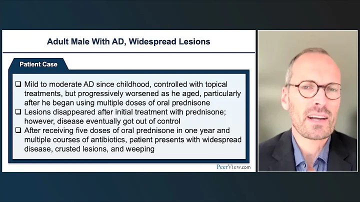 Expert Insights From Around the Globe on Tailoring Treatment for Patients With Atopic Dermatitis