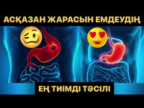 Бейне: Қысыммен ойық жараларды үйде емдеу